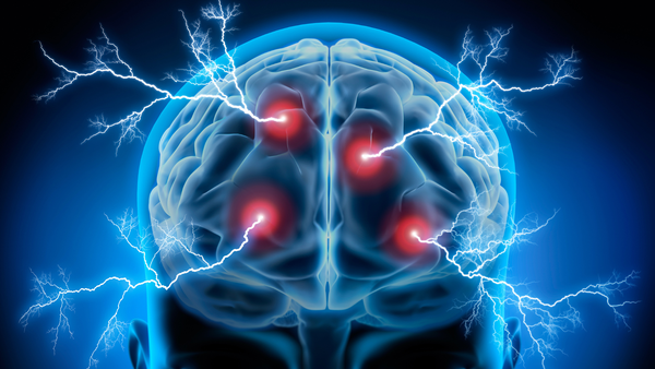 How to Protect Your Brain From Cognitive Decline in Your 30s